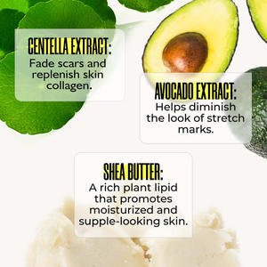 Crème anti-<span class=keywords><strong>vergetures</strong></span> OEM <span class=keywords><strong>pour</strong></span> éliminer <span class=keywords><strong>les</strong></span> <span class=keywords><strong>vergetures</strong></span> sur le ventre, réparation de la peau lâche, soin raffermissant, cadeau sain - Product Image 3