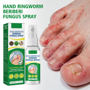 Spray Antifúngico Herbal Suave de 30ml para el Cuidado de Pies y Manos, Tratamiento para <span class=keywords><strong>Hongos</strong></span>, Tricodermatitis y Beriberi, Uso como Desodorante para Pies - Product Image 1