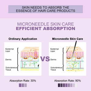 Vật liệu mới <span class=keywords><strong>Derma</strong></span> Con lăn đổ soins de Cheveux điều trị da mặt vẻ đẹp <span class=keywords><strong>Derma</strong></span> Con lăn 192 <span class=keywords><strong>Derma</strong></span> Con lăn cho tóc - Product Image 2