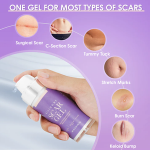Private Label Geavanceerde Siliconen Littekengel Medische Kwaliteit Striae Brandt Keloïde Acne Littekens Verwijderaar <span class=keywords><strong>Gel</strong></span> Voor Oude En Nieuwe Littekens - Product Image 6