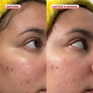 ETRUN ALISA Private Label Óleo Leve Breakout Balancing <span class=keywords><strong>Serum</strong></span> Reduzir Poros entupidos e Breakouts Manter a pele hidratada - Product Image 2