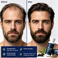 Sérum capillaire personnalisé aux peptides de cuivre Redensyl anti-chute, formule et flacons sur mesure OEM, marque privée