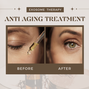 אקסו אקנה צלקת סרום ויטמין <span class=keywords><strong>C</strong></span> קולגן מחורפת הלבנה להחיות את הסרום לעור יבש תא האבקה - Product Image 4