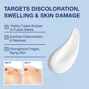 Face Body Hydrating Moisturizer Fast-Acting Arnica Montana Arnica <strong>Bruise</strong> <strong>Cream</strong> <strong>for</strong> Bruising Swelling Discoloration &amp; Thin Skin - Product Image 3
