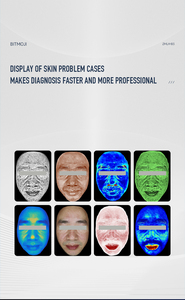 Envío Gratis, Gran Venta, Máquina de Análisis de Piel Digital 3D de Alta Definición, Prueba de Salud del Cuero Cabelludo, Máquina de Diagnóstico de Problemas de la Piel Facial - Product Image 4