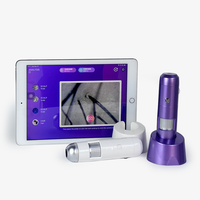 Analyseur de cuir chevelu de salon pour la densité des cheveux, les allergies et la machine de test des follicules pileux prenant en charge IOS et Android