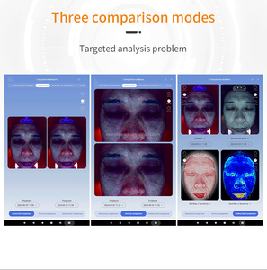 Máquina Profesional de Análisis de Piel con IA, Analizador de Piel Inteligente, Escáner <span class=keywords><strong>Digital</strong></span> de Piel, Máquina de Prueba y Análisis, Venta al por Mayor de Fábrica - Product Image 3