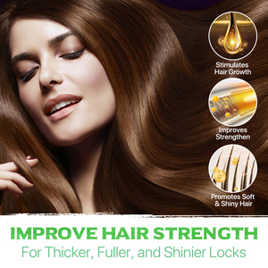 Yecuce Huiles Essentielles Traitement Du Cuir Chevelu Sec Aceite Para El Cabello Soins Des <span class=keywords><strong>Cheveux</strong></span> Produits Épaississants <span class=keywords><strong>Huile</strong></span> De Romarin pour Femmes - Product Image 6