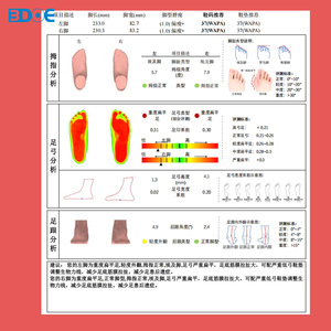 Dispositivo Inteligente 3DOE para Inspección de Pies en 3D: Sistema de Escaneo Láser 3D para Medición de <span class=keywords><strong>Pie</strong></span> Plano y Arco Alto - Product Image 3