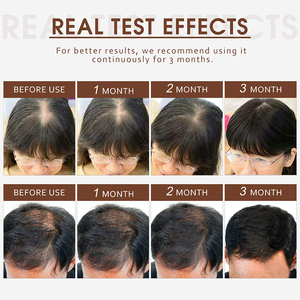 Le traitement à la biotine favorise la stimulation des racines des cheveux Huile essentielle répare le sérum de croissance des cheveux endommagés - Product Image 6