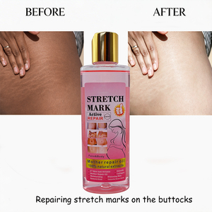 Aceite Reparador de Estrías, Aceite Reparador <span class=keywords><strong>para</strong></span> Madres, Vitamina E, Ácido Kójico, 4x Más Eficaz, Aceite Antiarrugas <span class=keywords><strong>para</strong></span> una Piel Suave, <span class=keywords><strong>para</strong></span> Cuerpo y Rostro, Venta al por Mayor - Product Image 2