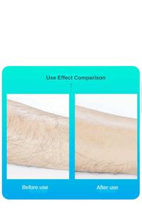 Épilateur Nano Crystal - Épilateur indolore exfoliant en caoutchouc avec <span class=keywords><strong>pierre</strong></span> de houblon pour hommes et femmes, outil de rasage corporel - Product Image 4