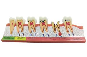 गाजर चित्रण विकास दंत दांत मॉडल - Product Image 2