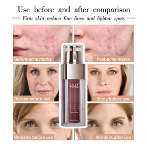 A doppio tubo per tutti gli usi emulsione per l'idratazione della pelle lozione antirughe ingredienti naturali miracolosi crema idratante per il viso - Product Image 6