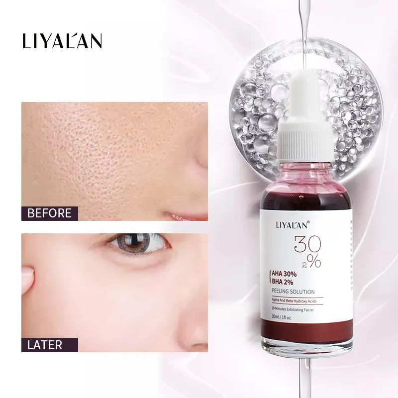 Private Label Custom Exfoliating Anti-Aging AHA 30% BHA 2% Facial Peeling Solution Whitening Acne Face Serum