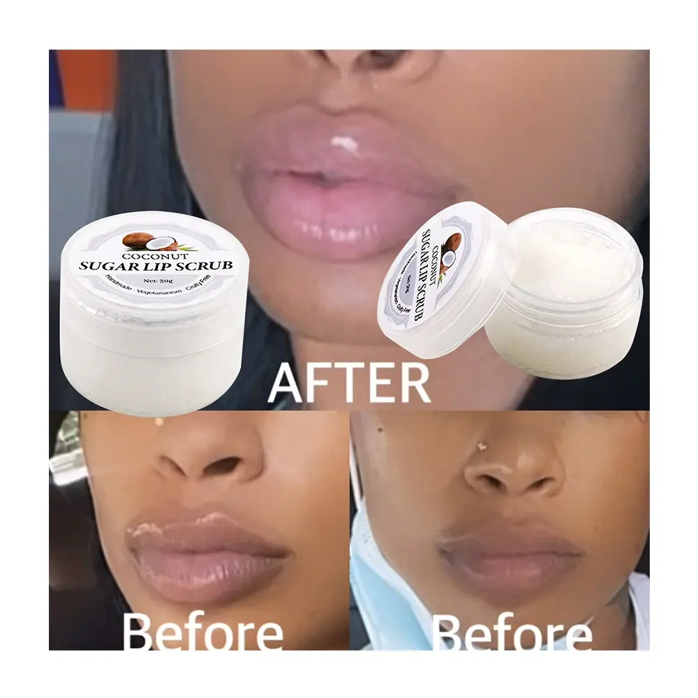 Custom Logo Exfoliërende Peeling Hydrating Lightening Voor Donkere Lippen Care Balm Scrub