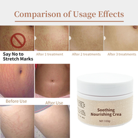 Crème Bio Anti-Vergetures Efficace – Meilleur Beurre Ventre pour l'Élimination des Vergetures et la Réparation Cutanée pour Femmes Enceintes