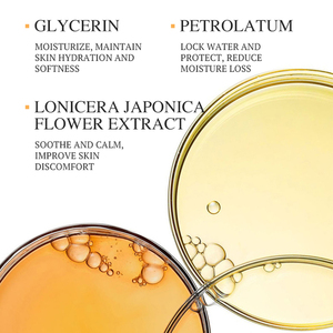 KORMESIC Crema al por mayor de 50g para alivio de venas varicosas, vasculitis, flebitis, arañas vasculares, ungüento y parche para el dolor de venas varicosas - Product Image 5