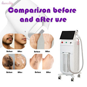 Máquina de Depilación Profesional de 4000W con Enfriamiento Vertical por Hielo, Sesiones Indoloras y Rápidas, Piel Suave de Larga Duración, Equipo de <span class=keywords><strong>Belleza</strong></span> - Product Image 6