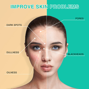 Maschera di fango di <span class=keywords><strong>argilla</strong></span> curcuma biologica <span class=keywords><strong>naturale</strong></span> <span class=keywords><strong>per</strong></span> la pulizia del <span class=keywords><strong>viso</strong></span> maschera di fango stick maschera di fango sbiancante professionale <span class=keywords><strong>per</strong></span> l'acne - Product Image 3