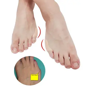 足部护理小脚趾拇趾矫正器硅胶脚趾凝胶分离器缓解小脚趾上的拇趾外翻拇趾