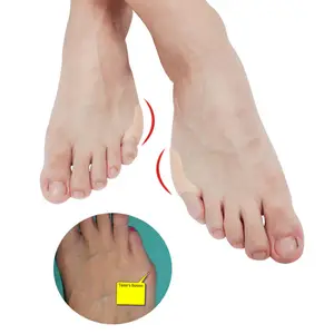 Korektor Bunion Jari Kaki Kecil Perawatan Kaki Orthotics Pemisah Gel Jari Kaki Silikon Eases Hallux Valgus Bunion Pada Jari Kelingking