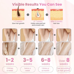 Vente en gros Meilleure mini machine portable d'épilation au laser indolore Épilateur laser à main d'épilation au laser Ipl pour femmes - Product Image 5