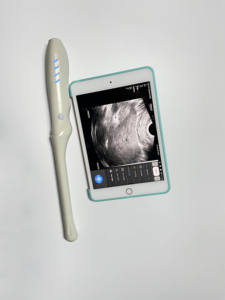 Machine à ultrasons de cavité de haute qualité Scanner de diagnostic de sonde à ultrasons sans fil portable pour une utilisation en clinique - Product Image 6