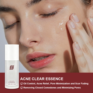 เซรั่มสำหรับสิวสูตรอ่อนโยนพร้อมกรดซาลิไซลิกและสังกะสีช่วยบรรเทาผิวอักเสบและรอยแผลเป็นจากโรงงาน - Product Image 2