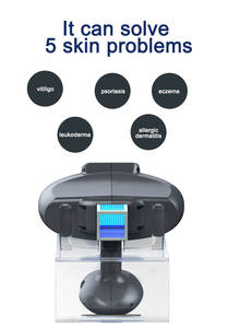 Semenanjung rumah menggunakan sistem fototerapi Laser, UVB 308nm Excimer untuk Vitiligo <span class=keywords><strong>Psoriasis</strong></span> pengobatan Ultraviolet - Product Image 3