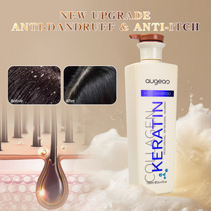 Wholesale Private Label keratin Natural Anti-Dandruff <b>Shampoo</b> Oil Control Itchy Scalp Care <b>Shampoo</b> - Product Image 2