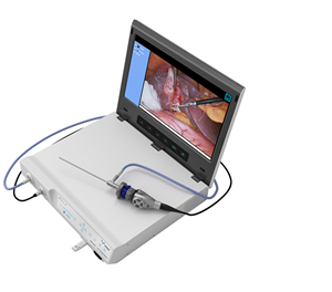 Sistema de Imagenología Médica Portátil FHD IKEDA YKD-9101 Todo en Uno, Cámara Urológica de Endoscopia Eléctrica, Equipo de Video ENT Integrado - Product Image 2