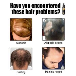 Wholesale 30ml <b>Hair</b> Growth Oil Herbal Extract Deep Nourishing Scalp <b>Hair</b> Loss Treatment <b>Hair</b> <b>Care</b> Spray - Product Image 5