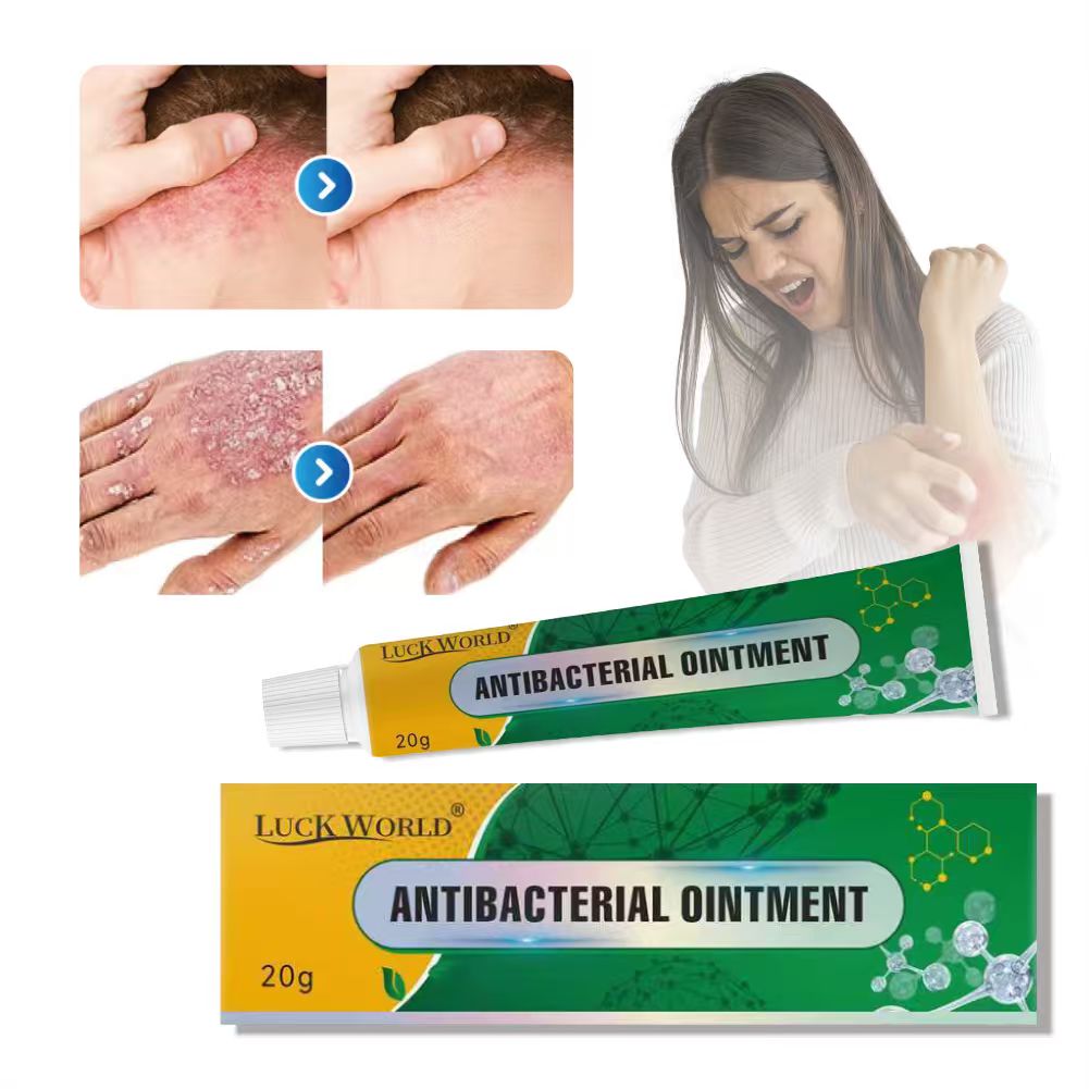 Factory Supply Antibacterial Herbal Formula Skin Care Eczema Ointment Ringworm Itching Cream for Body with Detox Benefits