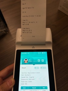 Analyseur d'immunoessai biochimique automatique pour test GLU/HBA1C CRE/MAU <span class=keywords><strong>AST</strong></span>/ALT FT3 FT4 VITAMINE B12 avec imprimante intérieure - Product Image 6