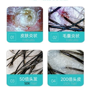 Salão De Beleza Profissional 9 Polegada Tela 50x Lente 200x Lente Skin Hair Analyser para Cuidados Com A Pele - Product Image 3