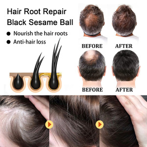 Soins capillaires, boules de sésame noir, <span class=keywords><strong>complément</strong></span> <span class=keywords><strong>alimentaire</strong></span> naturel à base de plantes, améliore l'immunité, favorise la croissance des <span class=keywords><strong>cheveux</strong></span>, anti-perte de <span class=keywords><strong>cheveux</strong></span>, renforce les <span class=keywords><strong>cheveux</strong></span> - Product Image 2