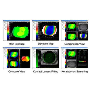 Instrumento Multifuncional de Topografía Corneal SW6000, Detector de Topografía Corneal para Clínica Oftalmológica, <span class=keywords><strong>Astigmatismo</strong></span>, Forma de la Córnea - Product Image 3