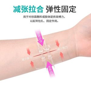 Parches de grado médico para reparación de cicatrices, correas elásticas, reductor de tensión de heridas transparente para la curación de primeros auxilios - Product Image 2