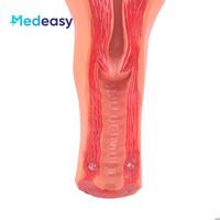 Modelo de Útero Femenino Desmontable Medeasy, Modelo de Vagina, Modelo Anatómico de Útero y Ovario Humano, Modelos de Ciencias Médicas