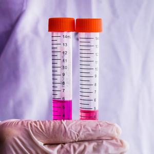 Laboratório fundo cônico plástico tubos centrífuga tubo <span class=keywords><strong>15mL</strong></span> com rosca - Product Image 1