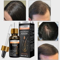 OEM Mejora el encrespamiento Aceite de jengibre para el cabello Aceite germinal de jengibre Aceite esencial para el crecimiento del cabello