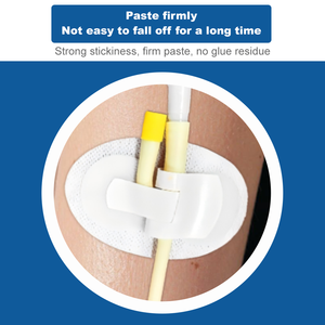 Kateter vena pusat kualitas tinggi, perangkat perbaikan kateter permukaan tubuh fiksasi (lumen ganda) - Product Image 5