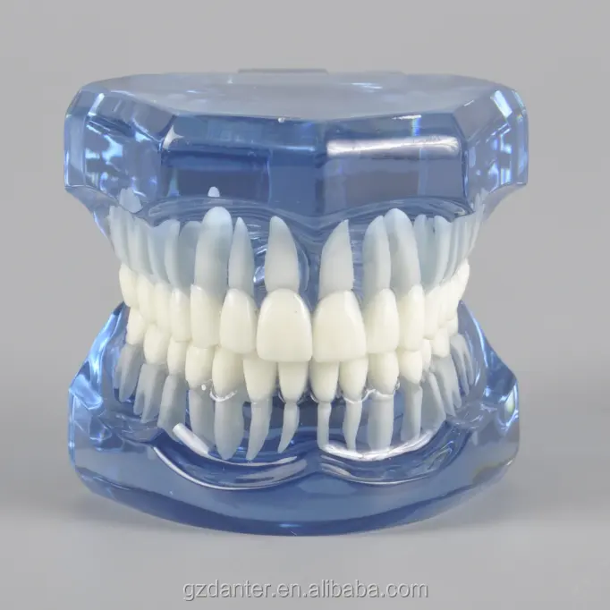 装具なしの透明な顎を備えた矯正歯科モデルタイポドン矯正歯研究モデルブレースなし青