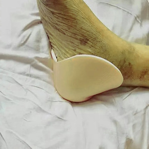 Medicazione adesiva in schiuma medica <span class=keywords><strong>per</strong></span> l'ulcera del piede diabetico e la ritenzione dell'umidità del tallone certificata CE - Product Image 4