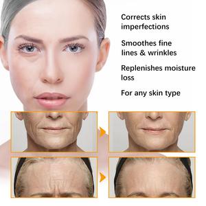 <span class=keywords><strong>Crema</strong></span> <span class=keywords><strong>Viso</strong></span> Giorno Sbiancante alla Curcuma Naturale all'Ingrosso per Schiarire la Pelle Protezione <span class=keywords><strong>Viso</strong></span> Sicura Giovane per Sempre Personalizzata - Product Image 4