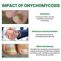 Sérum de Traitement Haute Qualité pour Mycoses des Ongles, Produits Réparateurs pour les Mycoses des Orteils, Gel de Soin Mains et Pieds, Anti-Onychomycose et Paronychie