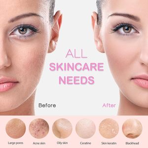 Cepillo <span class=keywords><strong>Facial</strong></span> Sónico <span class=keywords><strong>de</strong></span> <span class=keywords><strong>Silicona</strong></span> Recargable, 3 Modos, 4 Velocidades, <span class=keywords><strong>Limpiador</strong></span> <span class=keywords><strong>Facial</strong></span> Impermeable - Product Image 3