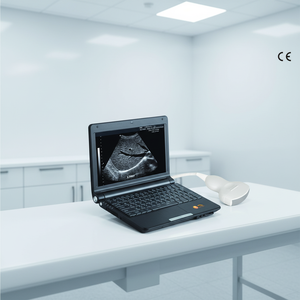 Échographe portable noir et blanc SUN-808S, appareil d'échographie portable - Product Image 1