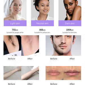 Nuovo Aggiornamento 2024 Macchina per Epilazione <span class=keywords><strong>Laser</strong></span> a Diodo Millennio 1800W Ice Titanium a 3 Onde (755 808 1064) Apparecchiatura Estetica <span class=keywords><strong>Laser</strong></span> - Product Image 5